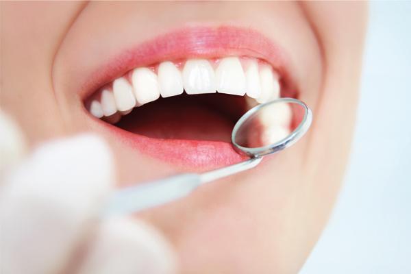 Hoe opnieuw witte tanden krijgen?
